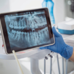 Опасен ли рентген зубов?⠀